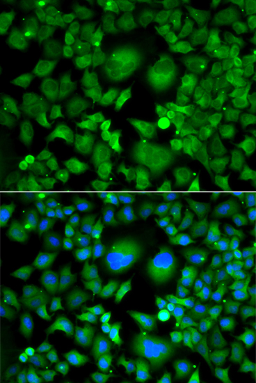 Anti-UBE2H Antibody