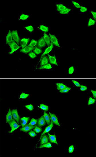 Anti-DNMT3A Antibody