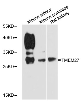 Anti-TMEM27 Antibody