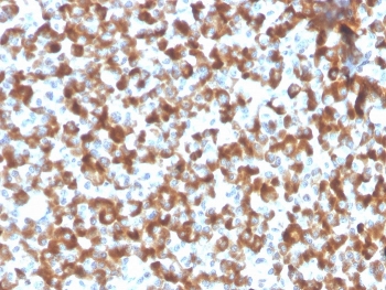 IHC staining of FFPE human pituitary tissue with recombinant FSH beta antibody (clone FSHb/2033R). HIER: boil tissue sections in pH 9 10mM Tris with 1mM EDTA for 20 min and allow to cool before testing.