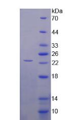 Figure. SDS-PAGE