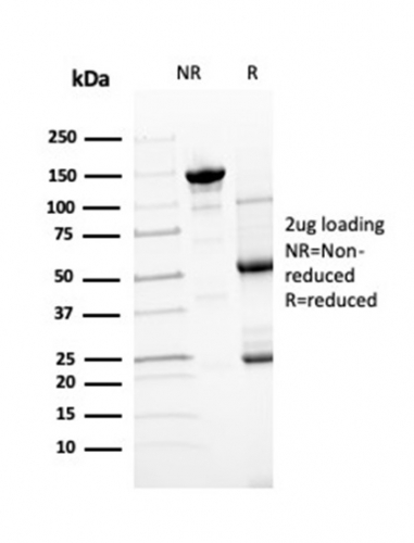 Anti-Transthyretin Antibody [TTR/4295] - BSA and Azide free