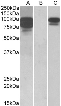 Anti-PCSK9 Antibody