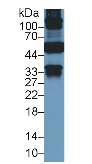 Western Blot; Sample: Human Liver lysate; Primary Ab: 2µg/ml Mouse Anti-Human KRT18 Antibody Second Ab: 0.2µg/mL HRP-Linked Caprine Anti-Mouse IgG Polyclonal Antibody