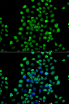 Anti-NTMT1 Antibody