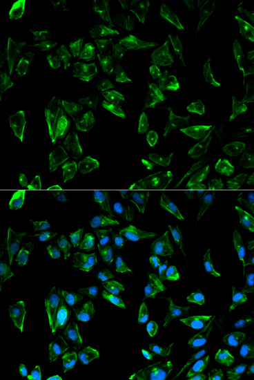 Anti-TPM3 Antibody
