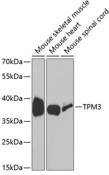 Anti-TPM3 Antibody