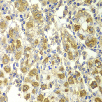 Anti-TNF-a Antibody