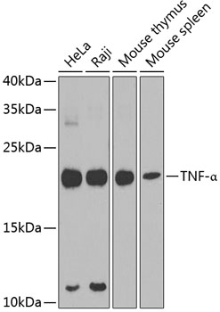 Anti-TNF-a Antibody
