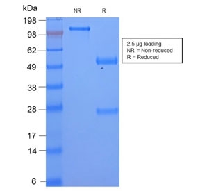 SDS-PAGE analysis of purified, BSA-free recombinant SAA antibody as confirmation of integrity and purity.