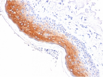 IHC staining of FFPE human skin with CK1 antibody (clone KRT1/1840). HIER: boil tissue sections in pH 9 10mM Tris with 1mM EDTA for 20 min and allow to cool before testing.