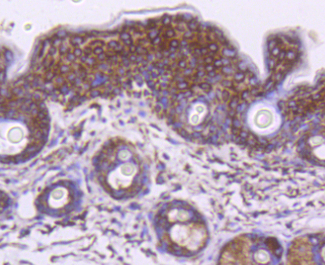 Anti-HSPD1 Antibody [Assigned #A10906]