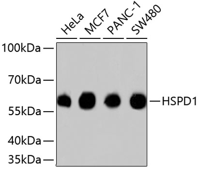 Anti-HSPD1 Antibody [Assigned #A10906]