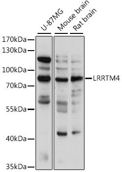 Anti-LRRTM4 Antibody
