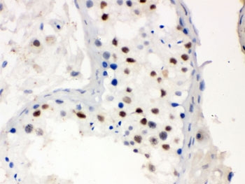 IHC testing of FFPE human testis with MNAT1 antibody. HIER: Boil the paraffin sections in pH 6, 10mM citrate buffer for 20 minutes and allow to cool prior to staining.