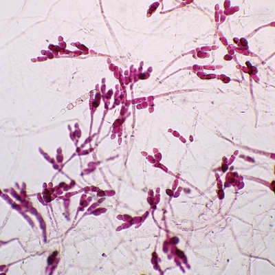 Allomyces Gametophyte, w.m. Microscope Slide