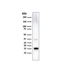 Western blot testing of human liver lysate with Transthyretin antibody. Predicted molecular weight ~16 kDa.