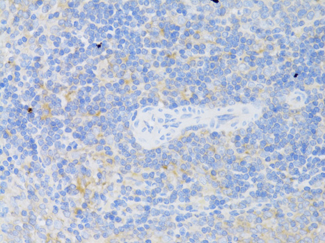 Anti-CD4 Antibody