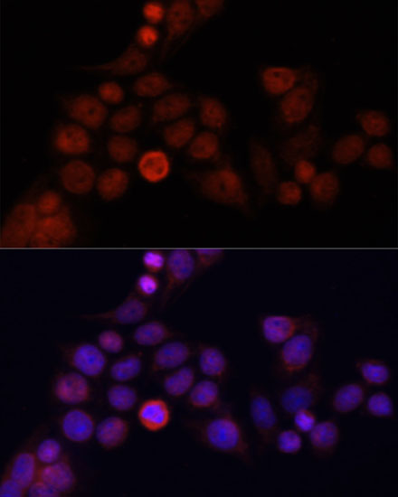 Anti-CD4 Antibody
