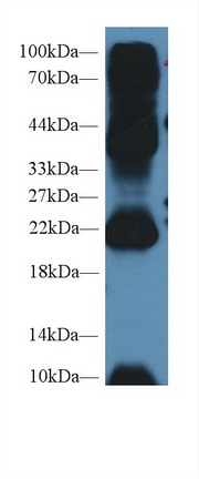Western Blot; Sample: Mouse Testis lysate; Primary Ab: 2µg/ml Rabbit Anti-Human AGR2 Antibody Second Ab: 0.2µg/mL HRP-Linked Caprine Anti-Rabbit IgG Polyclonal Antibody