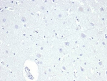 Negative control: IHC staining of FFPE human brain tissue using recombinant TROP2 antibody (clone TACSTD2/6396R) at 2ug/ml in PBS for 30min RT. HIER: boil tissue sections in pH 9 10mM Tris with 1mM EDTA for 20 min and allow to cool before testing.
