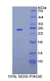 Figure. SDS-PAGE