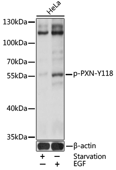 Anti-PXN (phospho Y118) Antibody