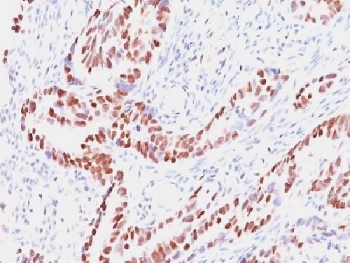 IHC testing of human colon with Retinoblastoma antibody (clone SPM353). Required HIER: boil tissue sections in pH 9 10mM Tris with 1mM EDTA for 10-20 min followed by cooling at RT for 20 min.