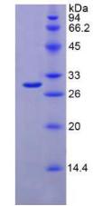 Figure. SDS-PAGE