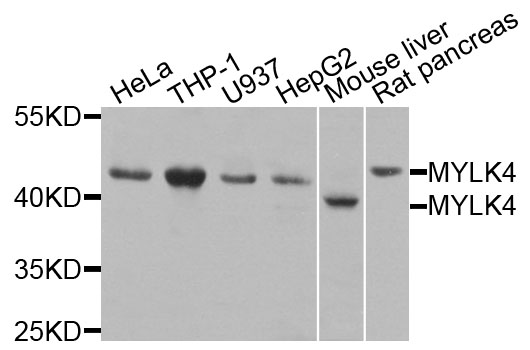 Anti-MYLK4 Antibody