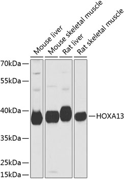 Anti-HOXA13 Antibody