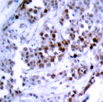 Anti-BCL2 (phospho S70) Antibody