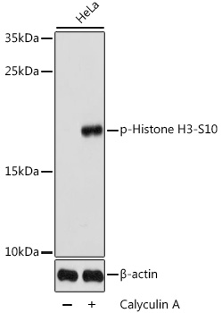 Anti-Histone H3 (phospho S10) Antibody