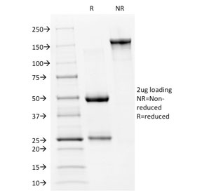 SDS-PAGE analysis of purified, BSA-free p53 antibody (clone PAb240) as confirmation of integrity and purity.