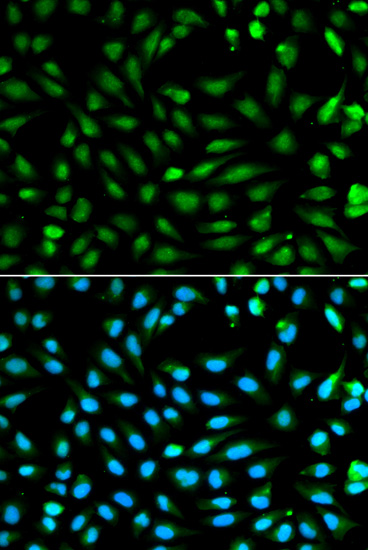 Anti-PCNA Antibody
