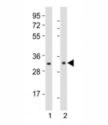 Western blot testing of Nkx2.5 antibody at 1:1000 dilution and mouse tissue; Lane 1: spleen lysate; 2: stomach lysate; Predicted molecular weight : 34 kDa.