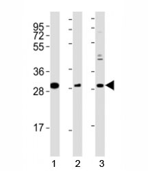 Western blot testing of Nkx2.5 antibody at 1:2000 dilution and mouse tissue; Lane 1: stomach lysate; 2: spleen lysate; 3: heart lysate; Predicted molecular weight : 34 kDa.