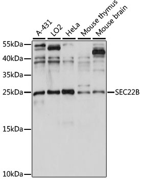 Anti-SEC22B Antibody