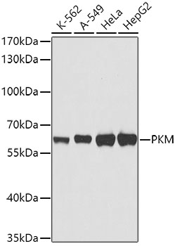 Anti-PKM Antibody [Assigned #A0540]