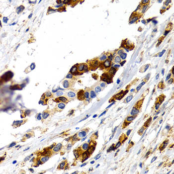Anti-TFF1 Antibody