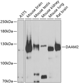 Anti-DAAM2 Antibody