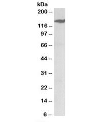 Western blot testing of rat kidney lysate with MAST3 antibody at 0.3ug/ml. Predicted molecular weight: ~143kDa.
