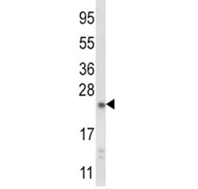 Western blot analysis of NQO2 antibody and mouse liver tissue lysate