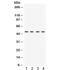 Western blot testing of 1) rat testis, 2) mouse brain, 3) human placenta and 4) human K562 lysate with Ribonuclease inhibitor antibody. Expected/observed molecular weight ~50 kDa.