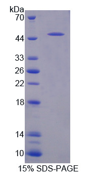 Figure. SDS-PAGE