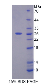 Figure. SDS-PAGE