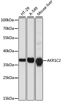 Anti-AKR1C2 Antibody