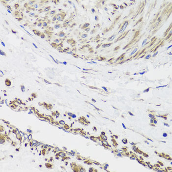 Anti-DES Antibody