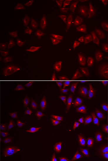Anti-PRAME Antibody