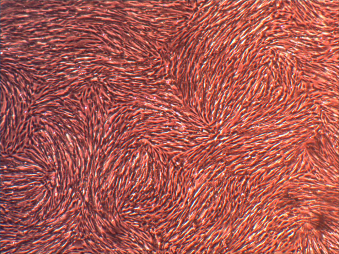 Primary Human Dermal Fibroblast Cells